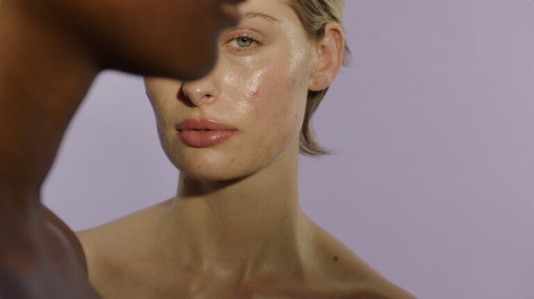 Gentle Skincare Routine for Adult Acne: A Complete Guide