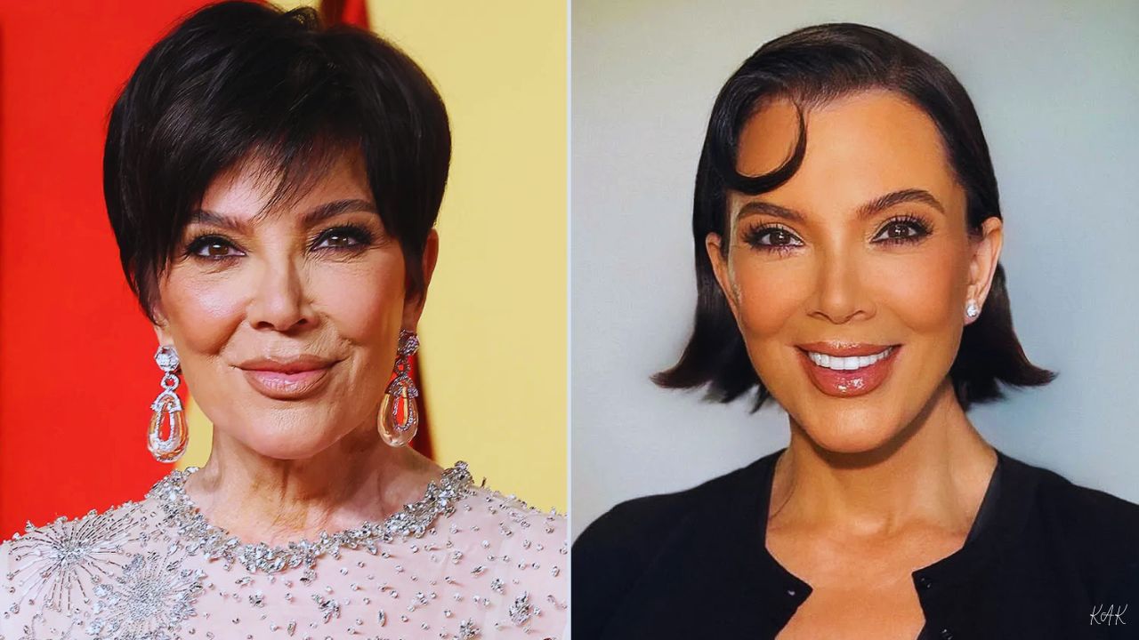 Kris Jenner facelift