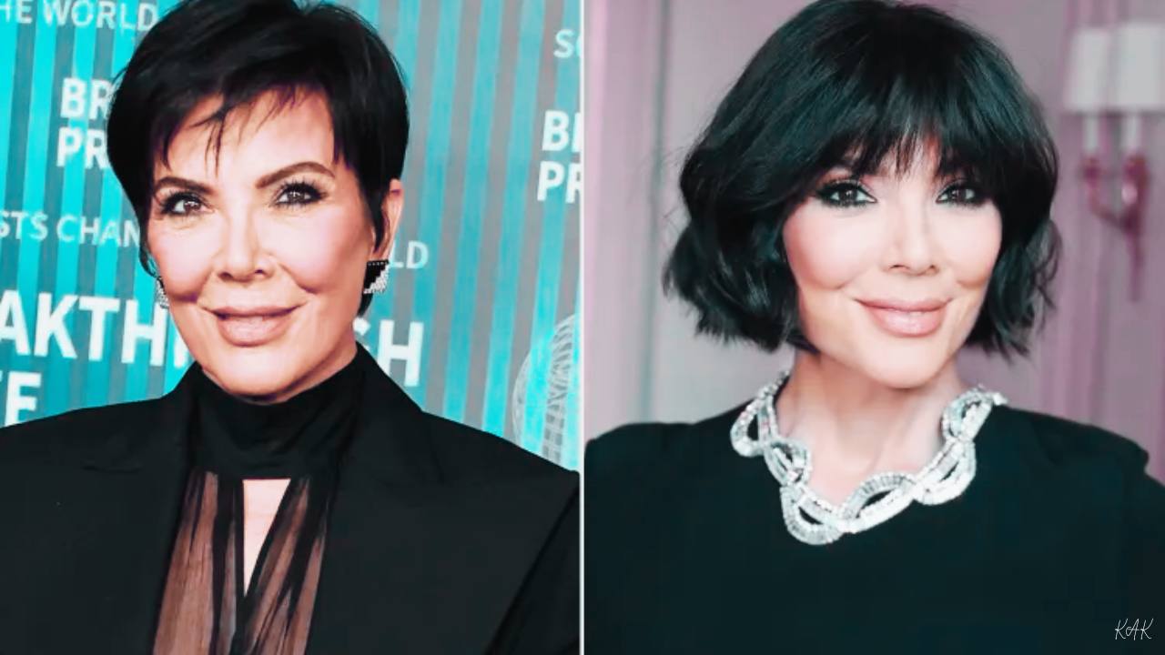 kris jenner after plastic surgery