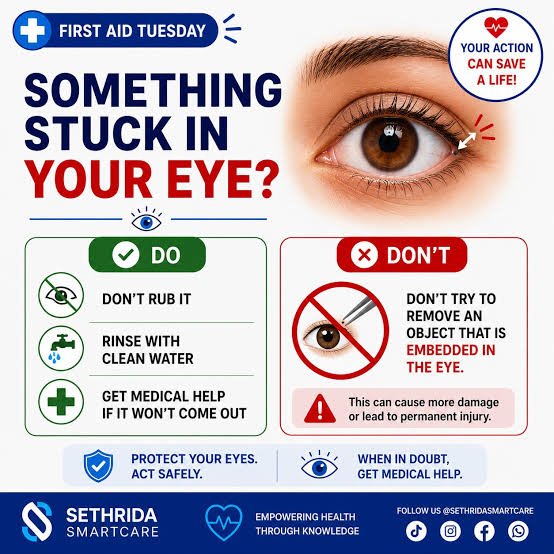 How to Get Something Out of Your Eye | Safe and Easy Methods